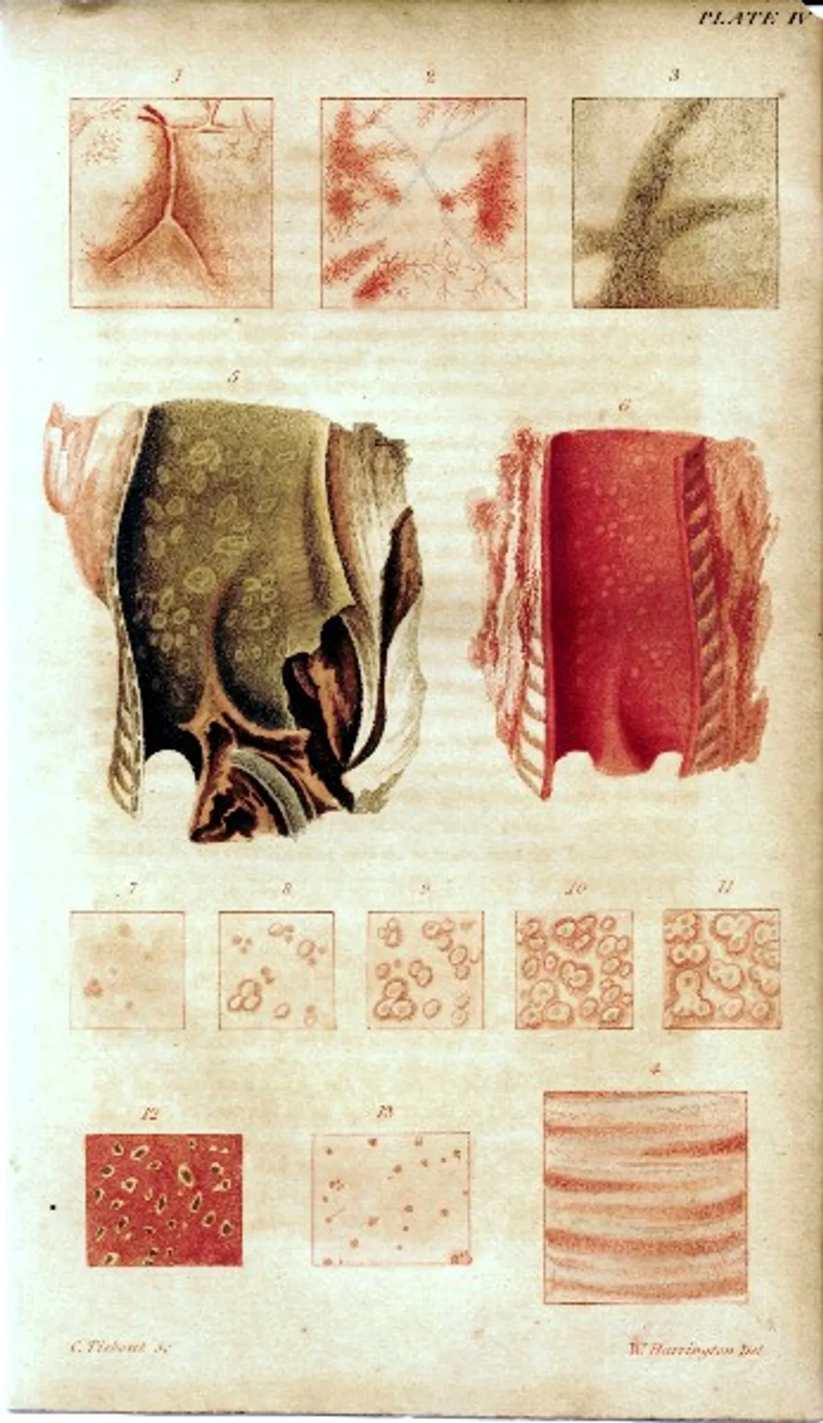 North American&hellip;